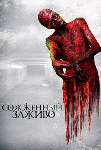 Сожженный заживо